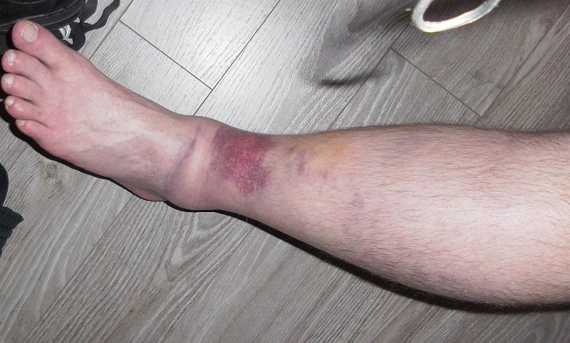 Sunday 17th June 2012 x2.jpg - Sunday evening after the tournament.